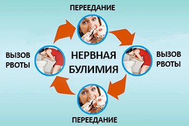 Лечение булимии в Называевске